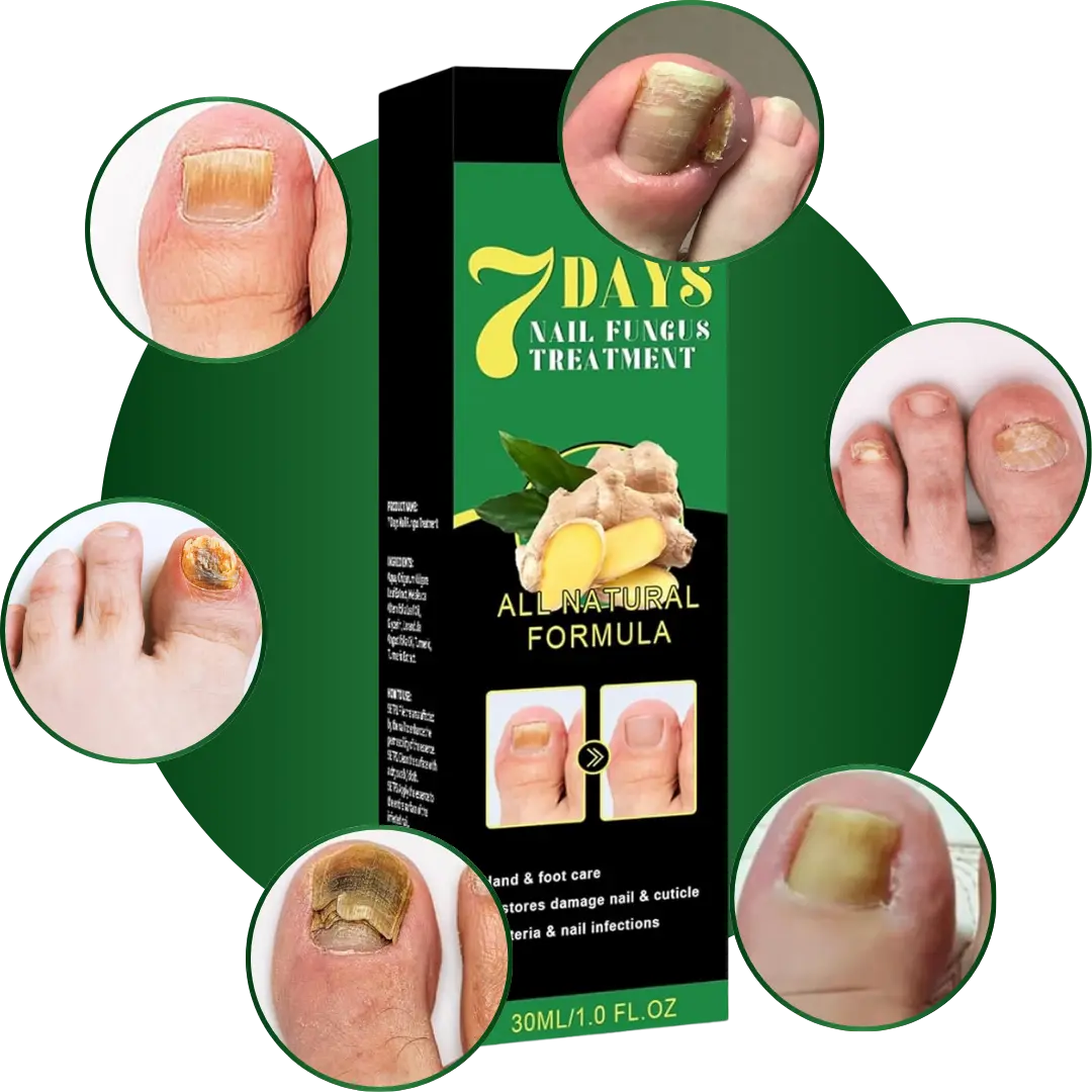 Serum Eliminador de Hongos 7 Days®