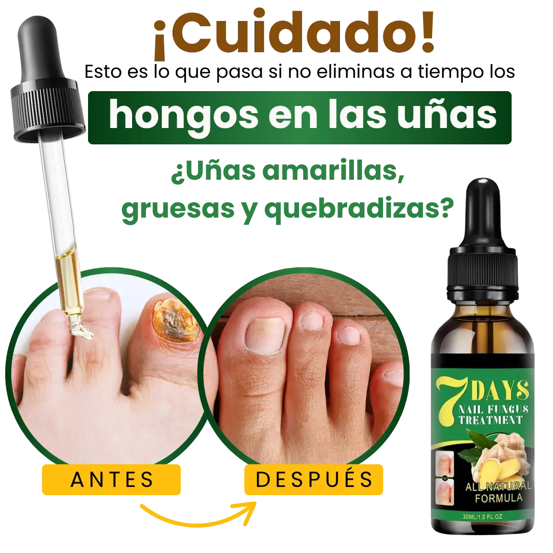 Serum Eliminador de Hongos 7 Days®