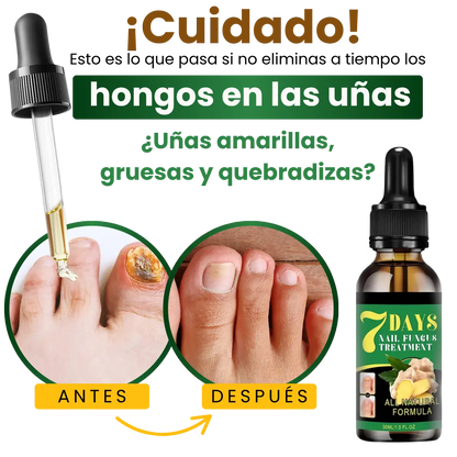 Serum Eliminador de Hongos 7 Days®