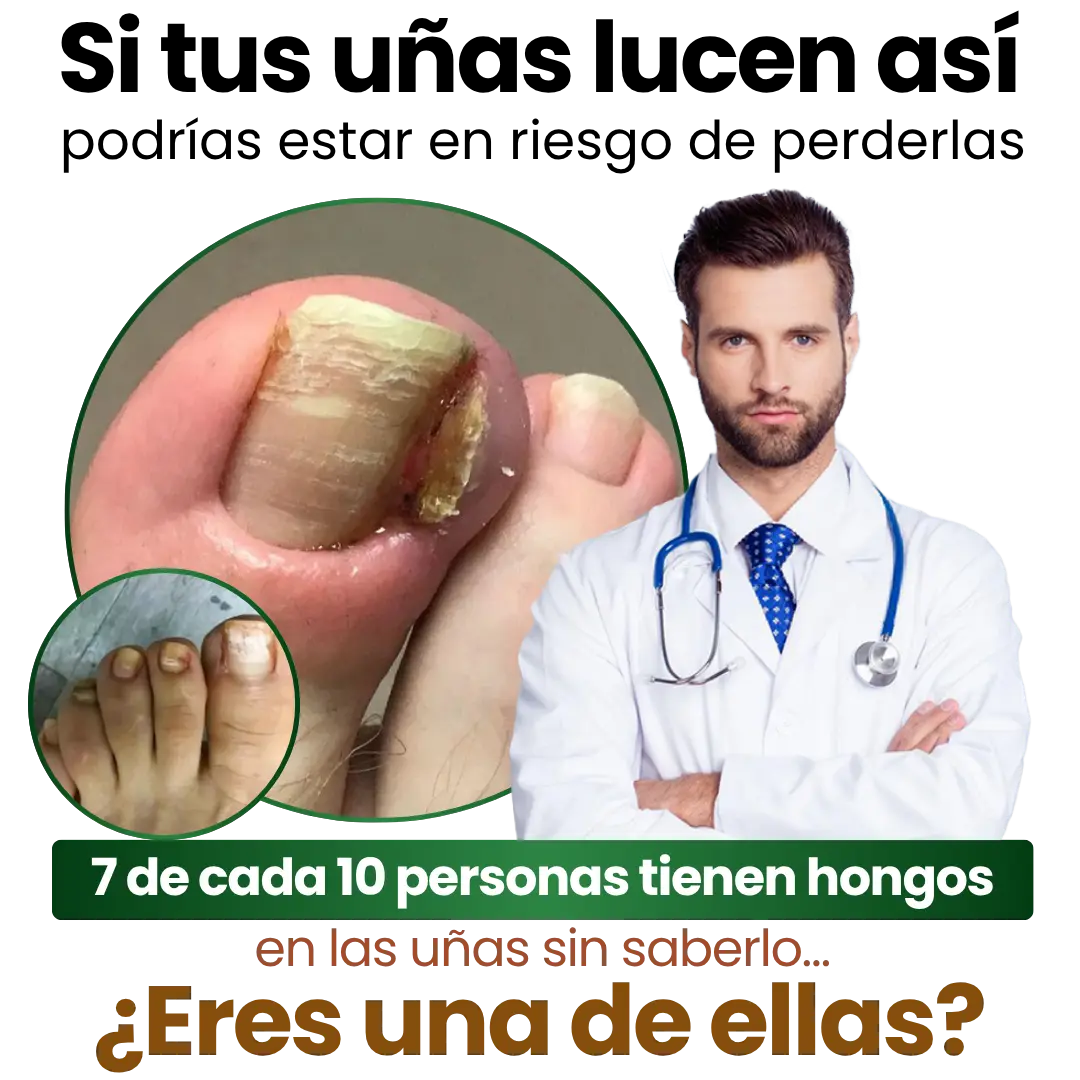 Serum Eliminador de Hongos 7 Days®